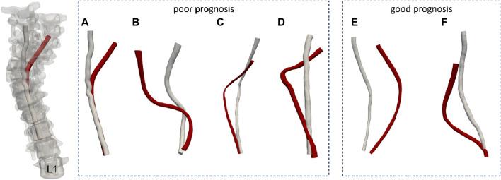 https://cdn.ncbi.nlm.nih.gov/pmc/blobs/f793/11249739/20576acdd951/fbioe-12-1399691-g001.jpg