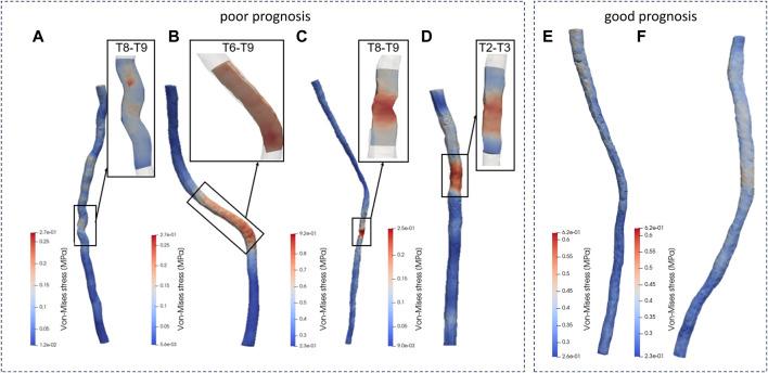 https://cdn.ncbi.nlm.nih.gov/pmc/blobs/f793/11249739/4b8e6400f330/fbioe-12-1399691-g005.jpg