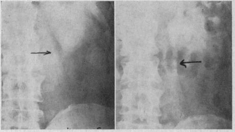 https://cdn.ncbi.nlm.nih.gov/pmc/blobs/f797/1521694/5a7dd92de231/califmed00212-0045-a.jpg
