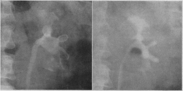 https://cdn.ncbi.nlm.nih.gov/pmc/blobs/f797/1521694/828f8f90c9d5/califmed00212-0046-a.jpg