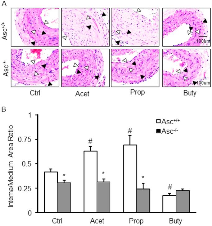 https://cdn.ncbi.nlm.nih.gov/pmc/blobs/f797/5842312/c0487828a830/gr4.jpg