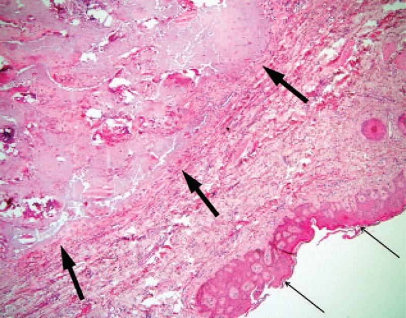 https://cdn.ncbi.nlm.nih.gov/pmc/blobs/f798/5406107/8cba01c78942/medi-96-e6733-g003.jpg