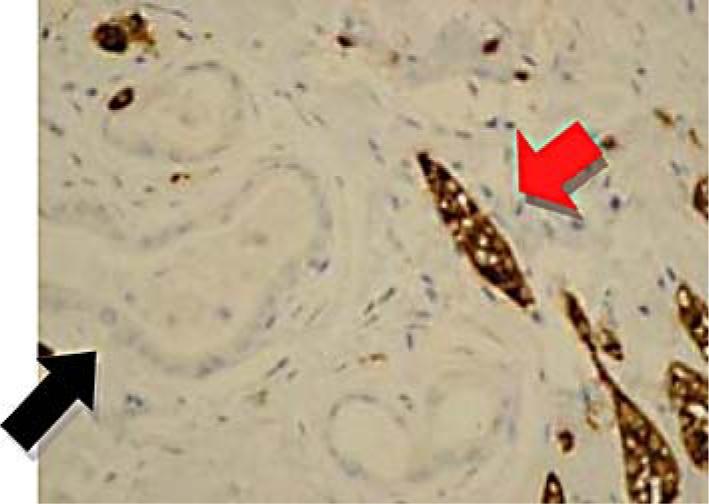 https://cdn.ncbi.nlm.nih.gov/pmc/blobs/f7a8/3088755/4638f9b80b1e/crg0005-0232-f05.jpg