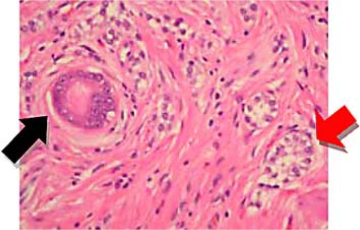 https://cdn.ncbi.nlm.nih.gov/pmc/blobs/f7a8/3088755/d1d18b14dafc/crg0005-0232-f04.jpg