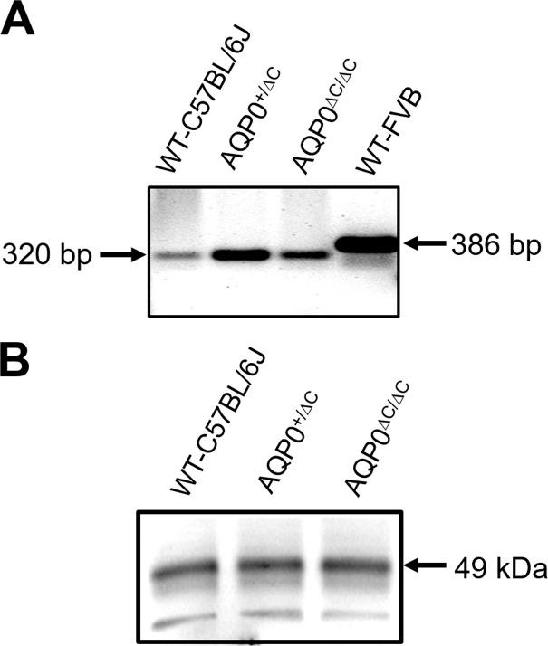 https://cdn.ncbi.nlm.nih.gov/pmc/blobs/f7a9/6397018/6bdb4aa330b3/i1552-5783-60-4-858-f03.jpg