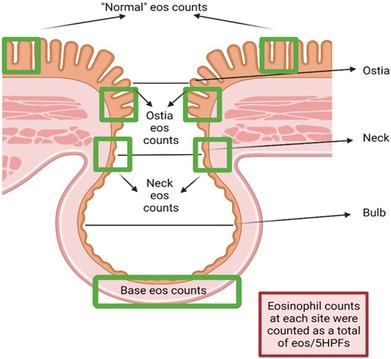 https://cdn.ncbi.nlm.nih.gov/pmc/blobs/f7ad/10946982/75b46acfbe30/JGH-38-1355-g005.jpg