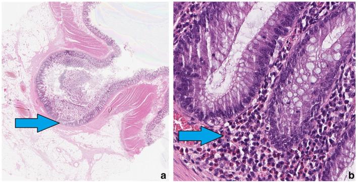 https://cdn.ncbi.nlm.nih.gov/pmc/blobs/f7ad/10946982/e5a6eca6c7d2/JGH-38-1355-g002.jpg