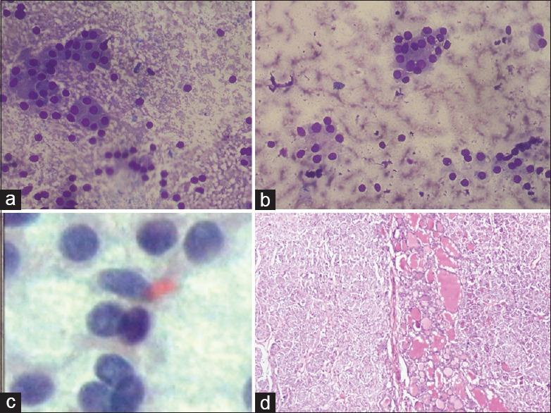 https://cdn.ncbi.nlm.nih.gov/pmc/blobs/f7ad/5492751/2d515faf30a5/JCytol-34-144-g001.jpg