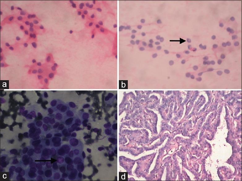 https://cdn.ncbi.nlm.nih.gov/pmc/blobs/f7ad/5492751/bc24270d5ac1/JCytol-34-144-g002.jpg