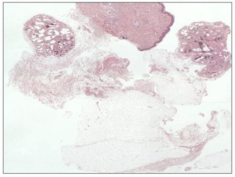https://cdn.ncbi.nlm.nih.gov/pmc/blobs/f7b1/3229078/dd422312be19/ad-23-S250-g002.jpg