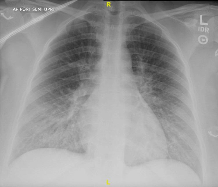 https://cdn.ncbi.nlm.nih.gov/pmc/blobs/f7bd/10917396/253419569991/cureus-0016-00000053643-i02.jpg