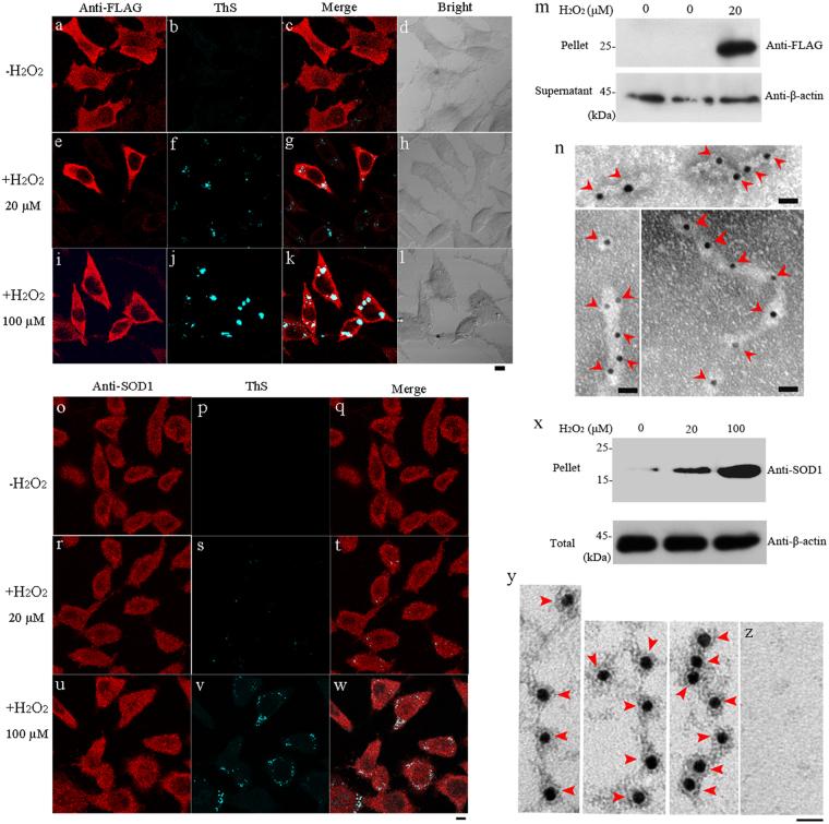 https://cdn.ncbi.nlm.nih.gov/pmc/blobs/f7be/5833406/d1f96997fcfb/41419_2017_106_Fig2_HTML.jpg