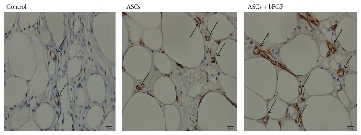 https://cdn.ncbi.nlm.nih.gov/pmc/blobs/f7bf/4324956/6ab13441998e/TSWJ2015-968057.003.jpg