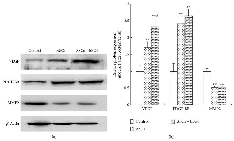 https://cdn.ncbi.nlm.nih.gov/pmc/blobs/f7bf/4324956/74f6f7f87d04/TSWJ2015-968057.004.jpg