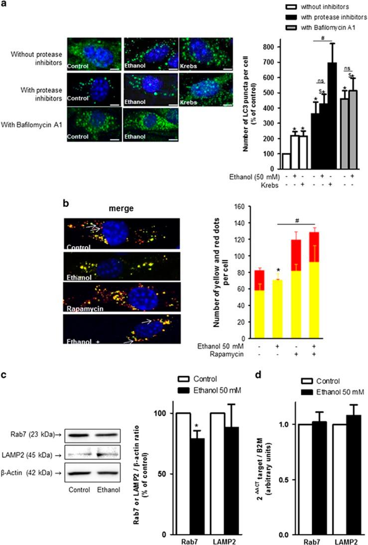 https://cdn.ncbi.nlm.nih.gov/pmc/blobs/f7bf/5386476/b3104800dd18/cddis201729f5.jpg