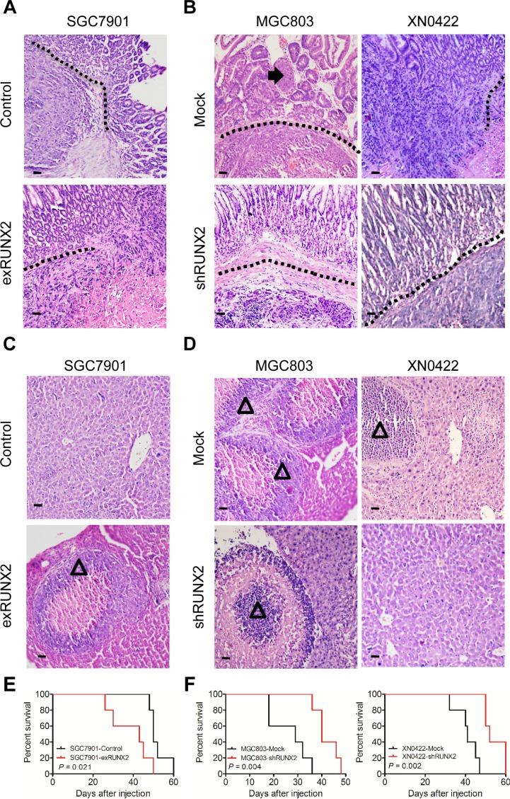 https://cdn.ncbi.nlm.nih.gov/pmc/blobs/f7c1/4991507/46819213ecbc/oncotarget-07-20999-g003.jpg