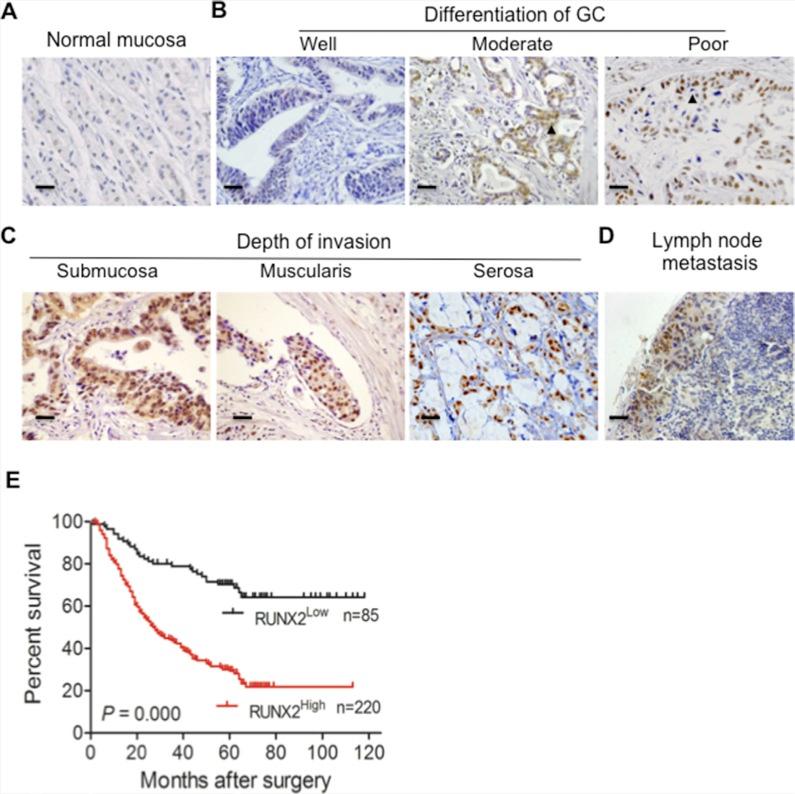 https://cdn.ncbi.nlm.nih.gov/pmc/blobs/f7c1/4991507/a1e9bb336903/oncotarget-07-20999-g001.jpg