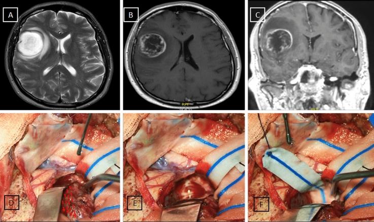 https://cdn.ncbi.nlm.nih.gov/pmc/blobs/f7c5/9992251/8605d4e0c9a6/11060_2022_4232_Fig2_HTML.jpg