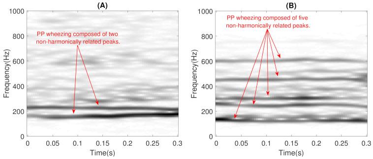 https://cdn.ncbi.nlm.nih.gov/pmc/blobs/f7c7/7957792/c020404dfec3/sensors-21-01661-g002.jpg