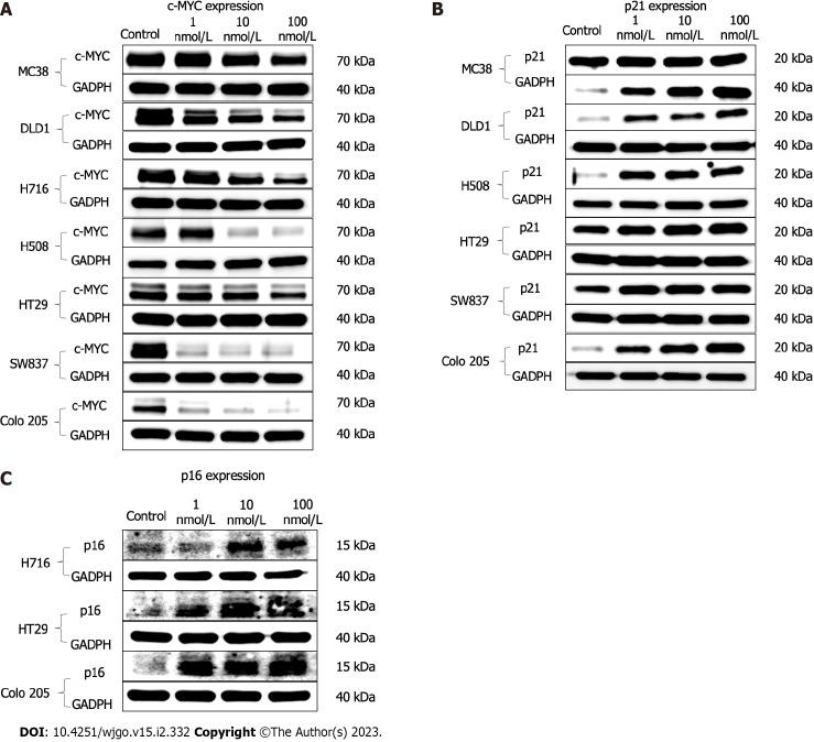 https://cdn.ncbi.nlm.nih.gov/pmc/blobs/f7da/9994054/9e4567357a40/WJGO-15-332-g002.jpg