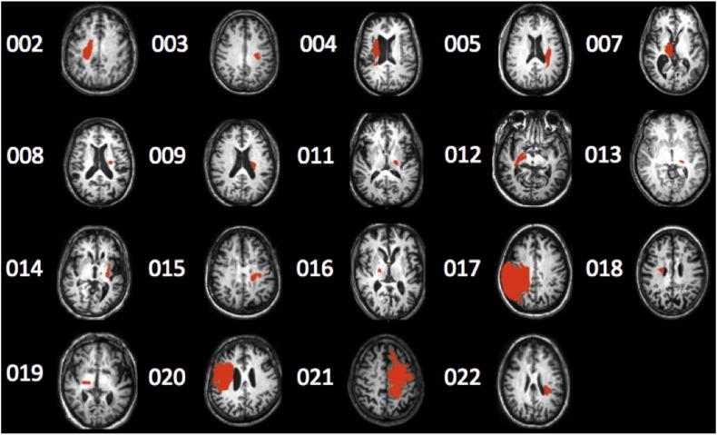 https://cdn.ncbi.nlm.nih.gov/pmc/blobs/f7e5/4683424/027600ac4279/gr1.jpg