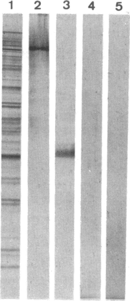 https://cdn.ncbi.nlm.nih.gov/pmc/blobs/f7e8/304932/31a98e458be3/pnas00276-0121-d.jpg