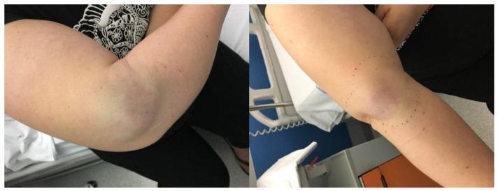 https://cdn.ncbi.nlm.nih.gov/pmc/blobs/f7ea/6210570/3eca539c31bc/cancers-10-00350-g005.jpg