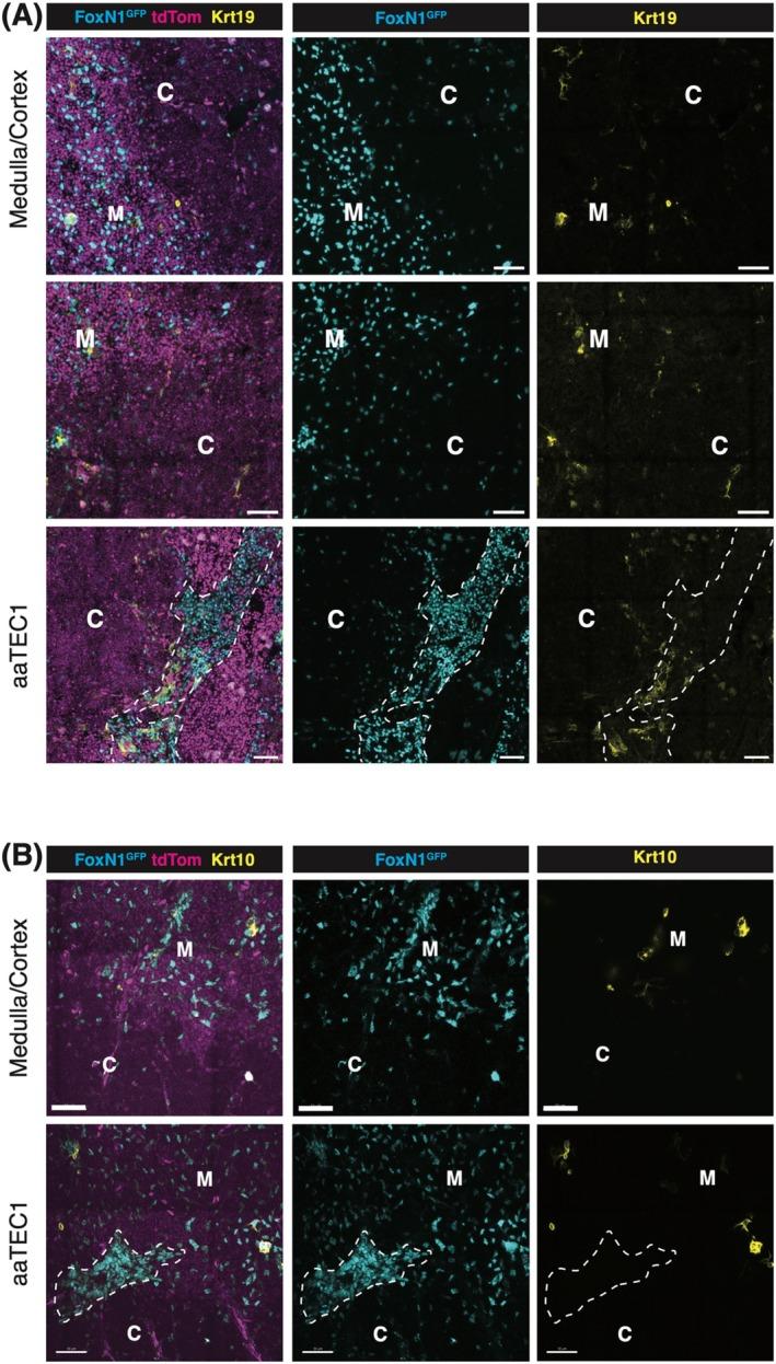 https://cdn.ncbi.nlm.nih.gov/pmc/blobs/f7ee/12188952/f719df0842b6/IMR-332-0-g001.jpg