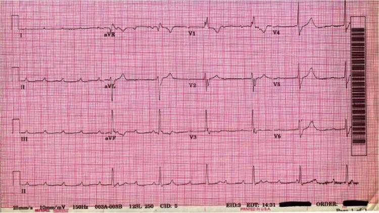 https://cdn.ncbi.nlm.nih.gov/pmc/blobs/f7f0/3658225/23312478f428/imcrj-3-071Fig2.jpg