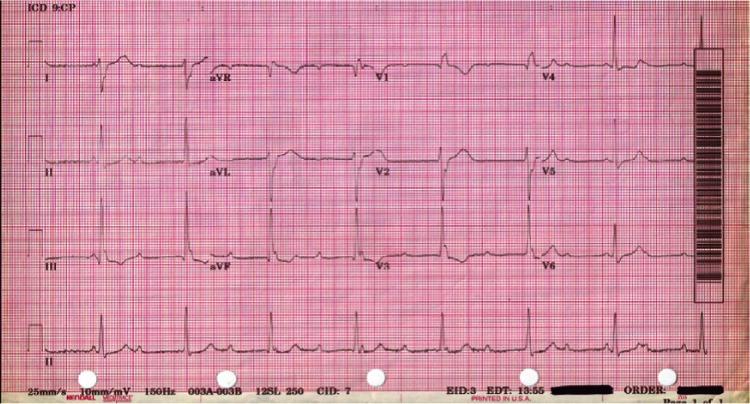 https://cdn.ncbi.nlm.nih.gov/pmc/blobs/f7f0/3658225/d0cbfe146ed4/imcrj-3-071Fig1.jpg