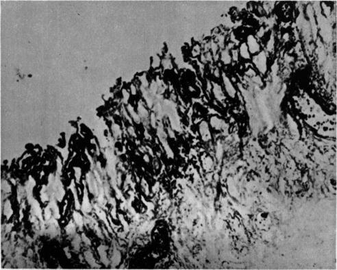 https://cdn.ncbi.nlm.nih.gov/pmc/blobs/f7f5/2051607/63e65e2b4ac7/brmedj03649-0008-b.jpg