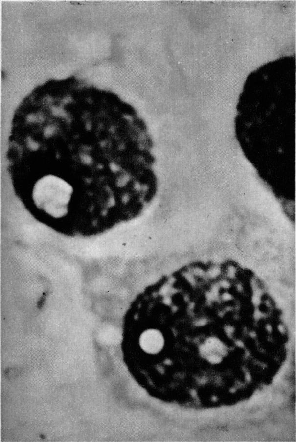 https://cdn.ncbi.nlm.nih.gov/pmc/blobs/f7f5/2051607/b88805b9f5a9/brmedj03649-0008-f.jpg