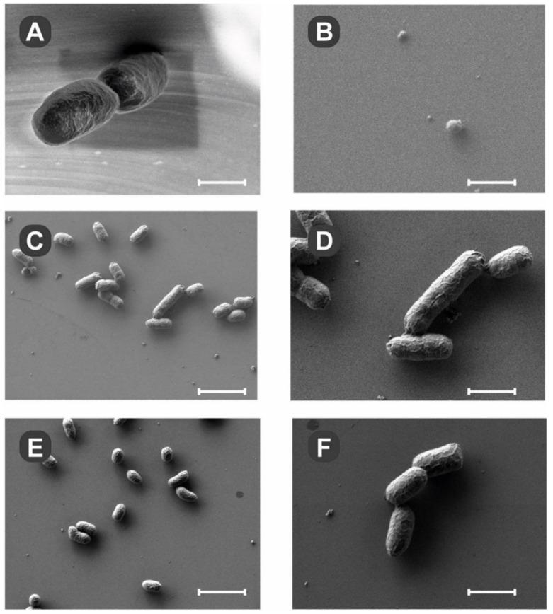 https://cdn.ncbi.nlm.nih.gov/pmc/blobs/f7f5/8267647/4528653399a3/ijms-22-06762-g003.jpg