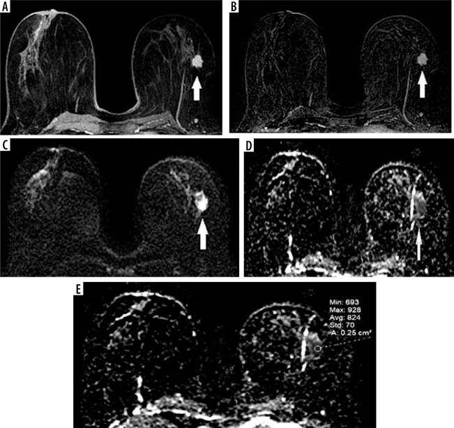 https://cdn.ncbi.nlm.nih.gov/pmc/blobs/f7f7/8186308/adc5d4532821/PJR-86-44058-g002.jpg