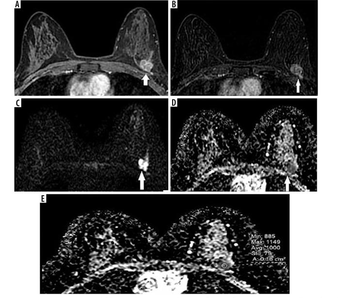 https://cdn.ncbi.nlm.nih.gov/pmc/blobs/f7f7/8186308/e795d2477f13/PJR-86-44058-g001.jpg