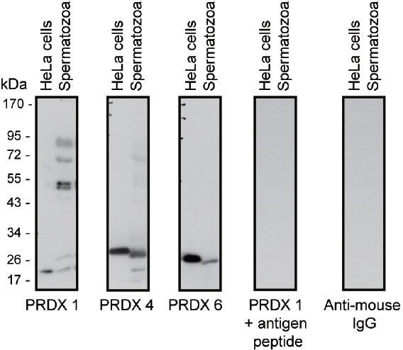 https://cdn.ncbi.nlm.nih.gov/pmc/blobs/f804/5227679/23c60ac4ce9a/AJA-19-73-g003.jpg