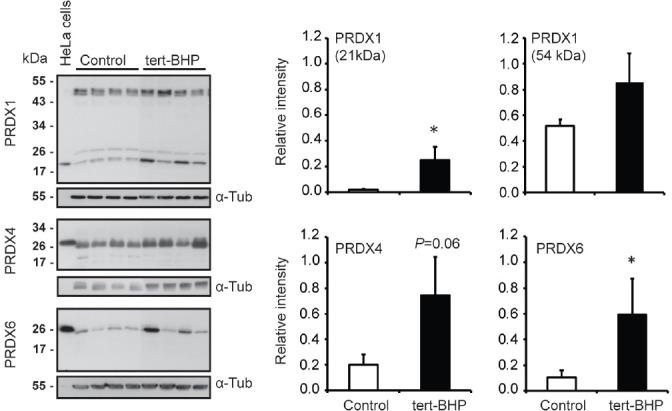 https://cdn.ncbi.nlm.nih.gov/pmc/blobs/f804/5227679/e64f9e38319d/AJA-19-73-g004.jpg