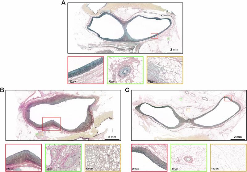 https://cdn.ncbi.nlm.nih.gov/pmc/blobs/f80b/11718002/bd964e51ed4f/41467_2025_55933_Fig4_HTML.jpg
