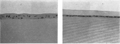 https://cdn.ncbi.nlm.nih.gov/pmc/blobs/f80d/1316510/1dcad2008a92/taos00039-0516-b.jpg