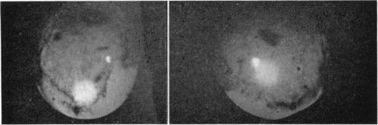 https://cdn.ncbi.nlm.nih.gov/pmc/blobs/f80d/1316510/41dfd59752c9/taos00039-0526-c.jpg