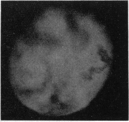 https://cdn.ncbi.nlm.nih.gov/pmc/blobs/f80d/1316510/42671db714de/taos00039-0515-c.jpg