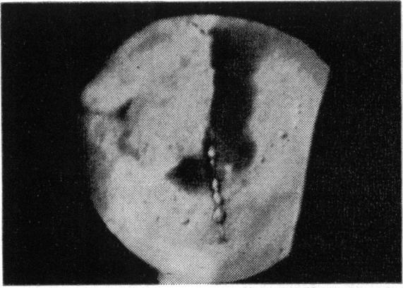 https://cdn.ncbi.nlm.nih.gov/pmc/blobs/f80d/1316510/587206853c15/taos00039-0510-a.jpg