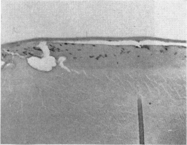 https://cdn.ncbi.nlm.nih.gov/pmc/blobs/f80d/1316510/6d26fbb63090/taos00039-0515-e.jpg