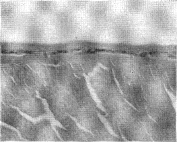 https://cdn.ncbi.nlm.nih.gov/pmc/blobs/f80d/1316510/c4754dc2fd19/taos00039-0515-d.jpg