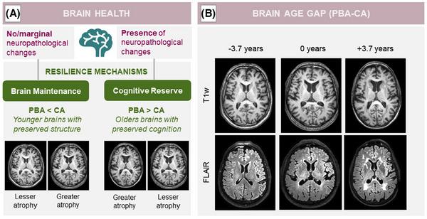 https://cdn.ncbi.nlm.nih.gov/pmc/blobs/f80e/11848408/6d37672f75a5/ALZ-21-e14435-g001.jpg