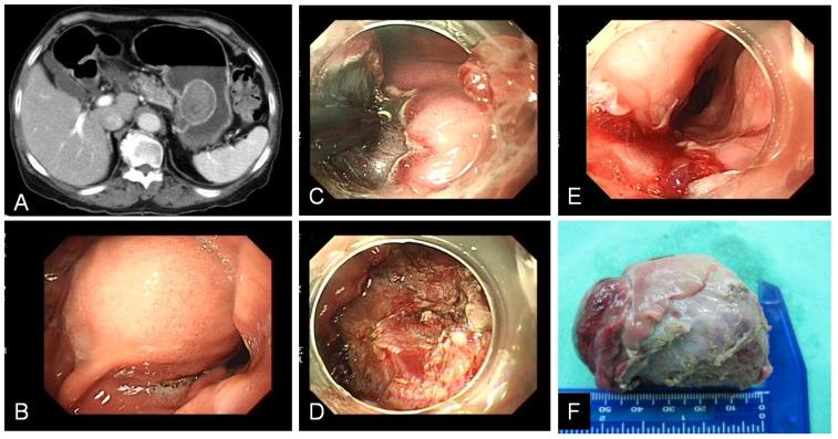 https://cdn.ncbi.nlm.nih.gov/pmc/blobs/f814/7778549/e248daac0a62/jcav12p0765g002.jpg