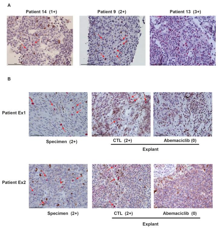https://cdn.ncbi.nlm.nih.gov/pmc/blobs/f814/7961994/078bdcc60206/cancers-13-01104-g002.jpg