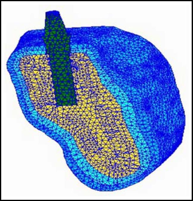 https://cdn.ncbi.nlm.nih.gov/pmc/blobs/f816/3809236/1b760398dc1a/pjms-29-619-g001.jpg