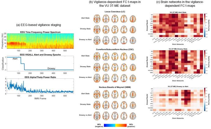 https://cdn.ncbi.nlm.nih.gov/pmc/blobs/f819/12330857/acb12a7cd098/IMAG.a.91_Fig2.jpg
