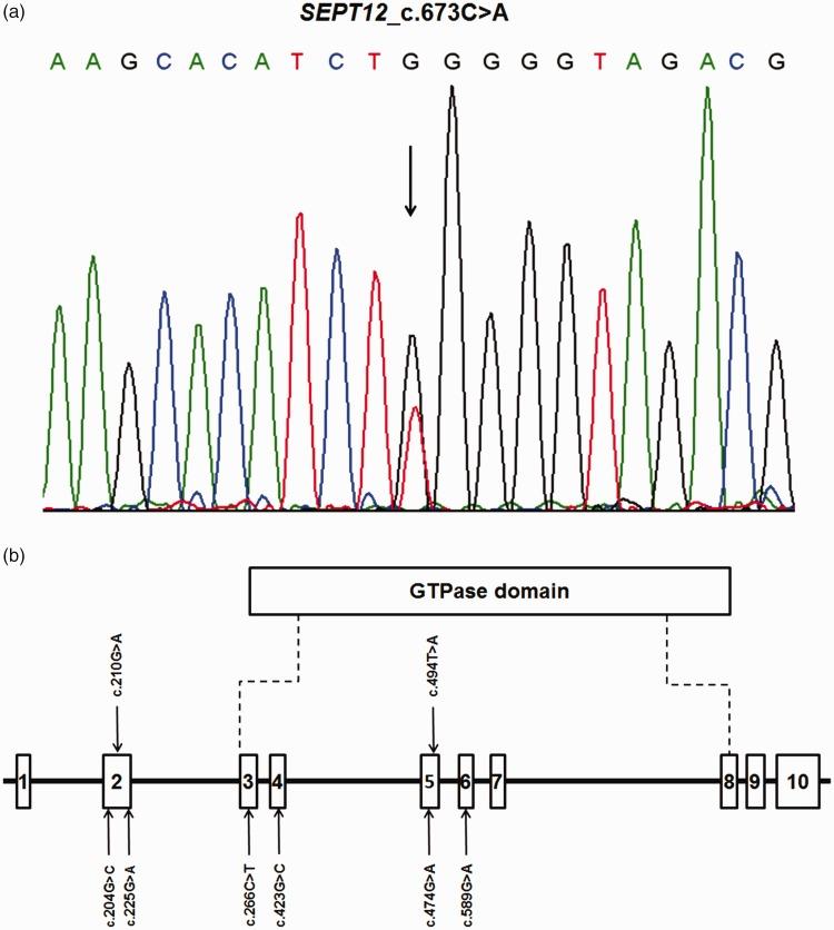 https://cdn.ncbi.nlm.nih.gov/pmc/blobs/f81b/6381467/bf39c8f6b479/10.1177_0300060518811770-fig1.jpg